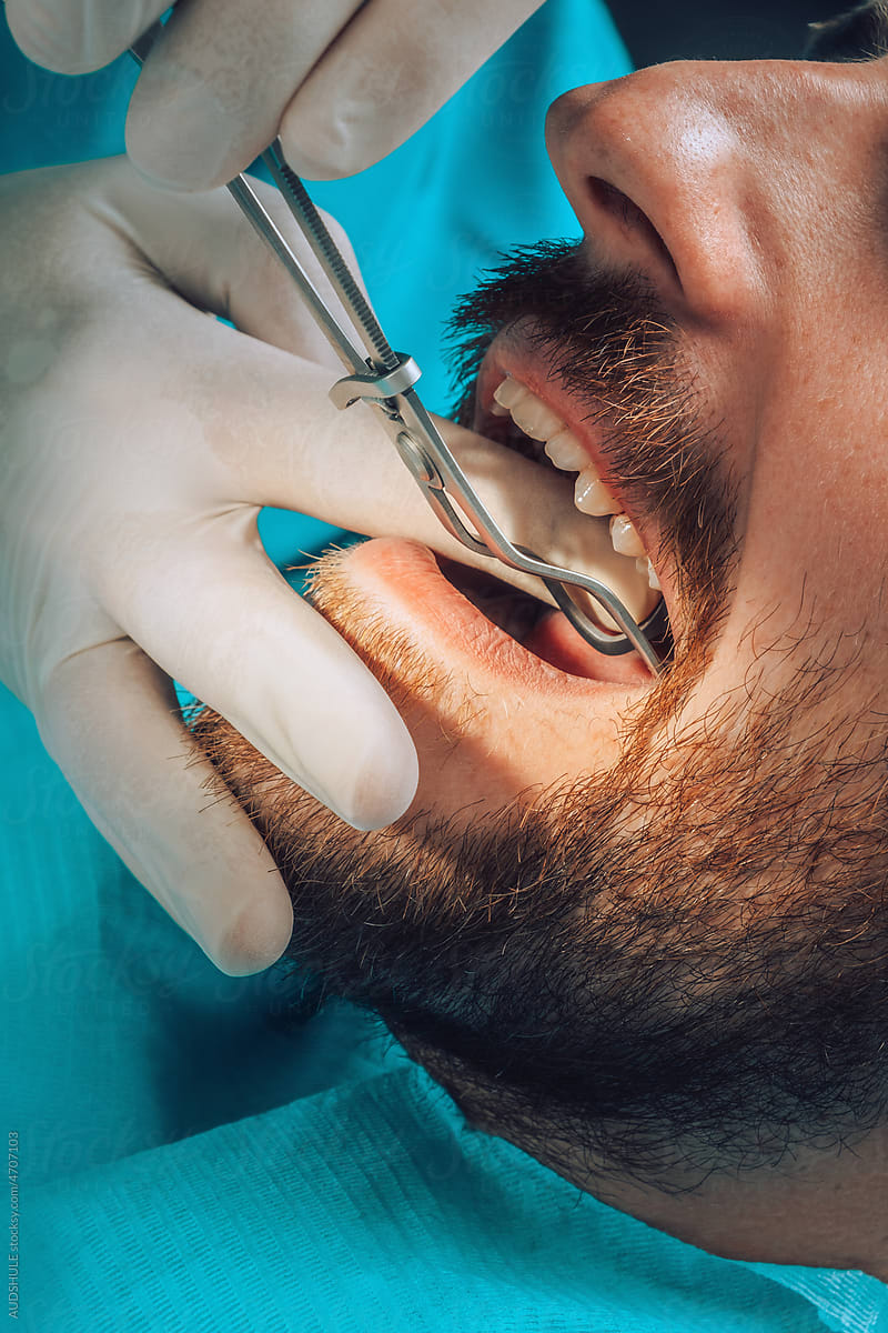 Detail during dental surgery with instruments and patient teeth