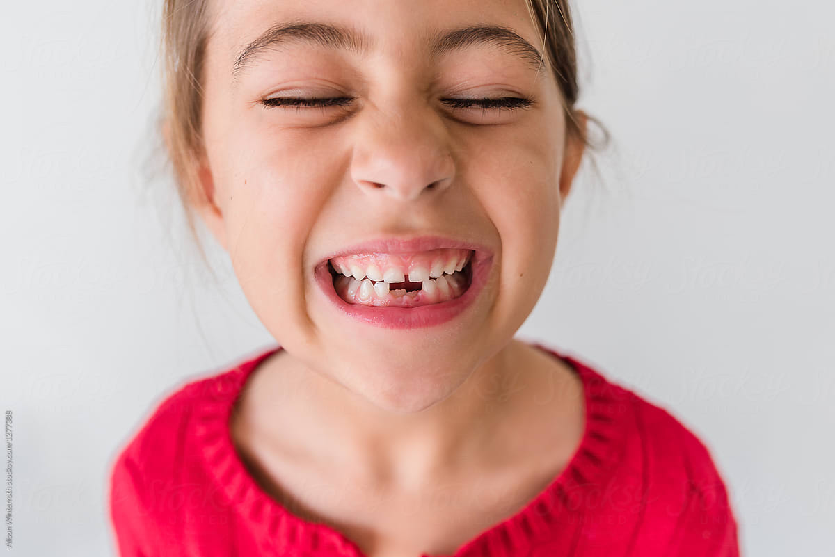 Smiling Girl Showing Her Missing Teeth