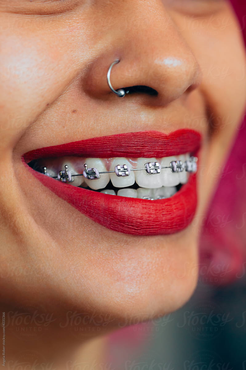 Profile of smiling woman with braces