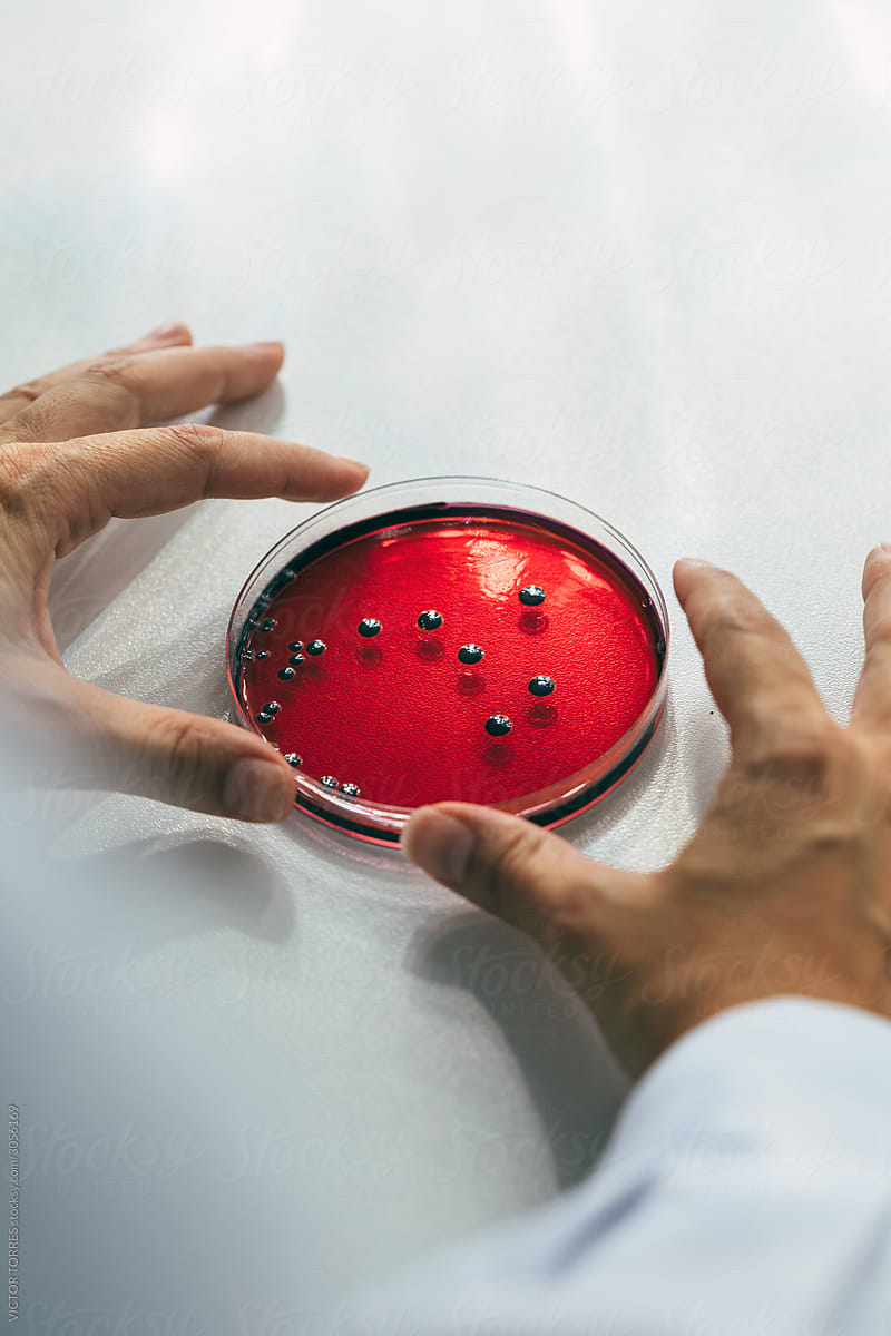 Woman examining petri dishes in the lab