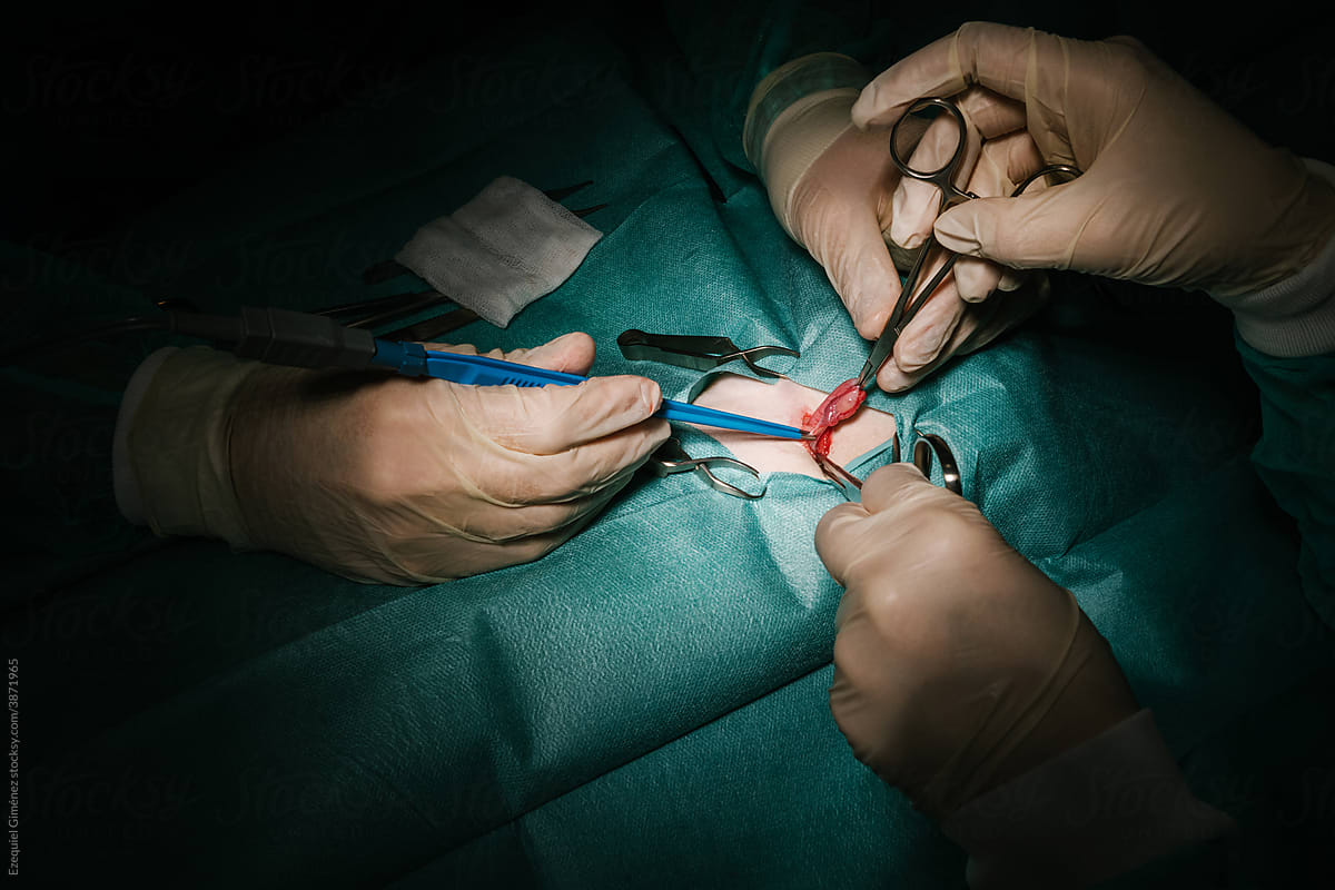 Anonymous hands of surgeons operating in a clinic.