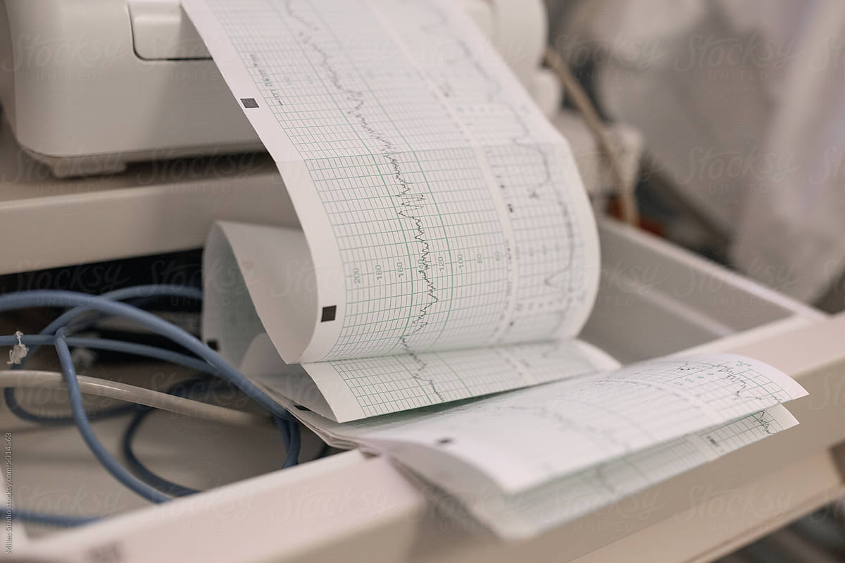 Electrocardiogram strip in opened drawer
