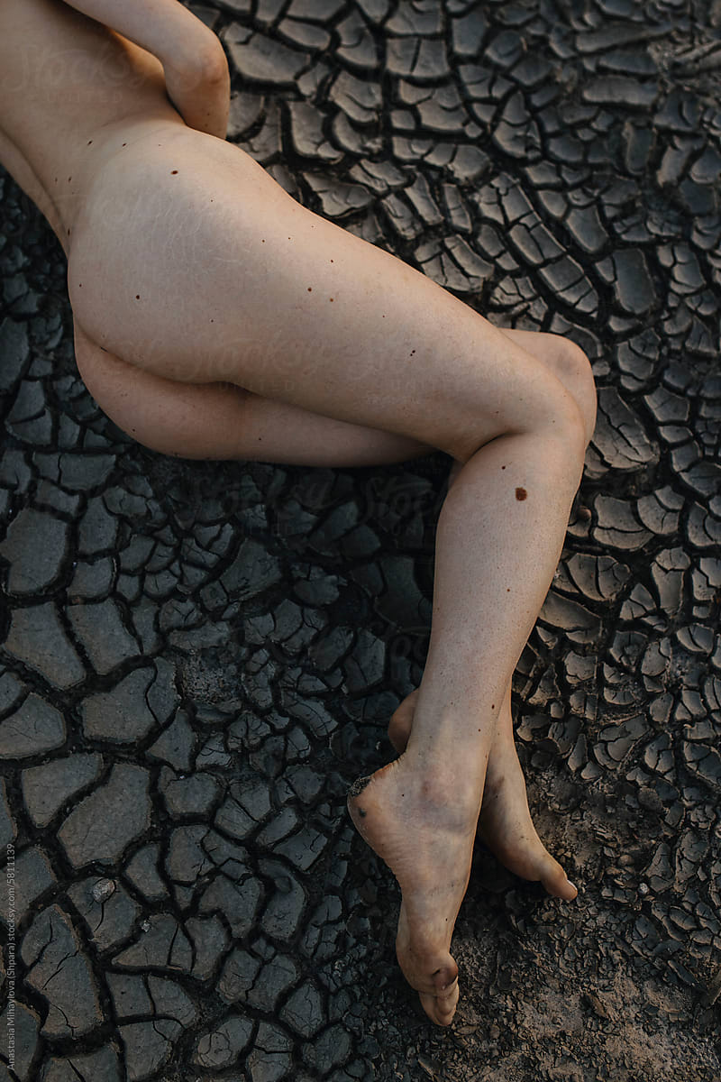 Photo of white skin texture of legs with big moles on the body