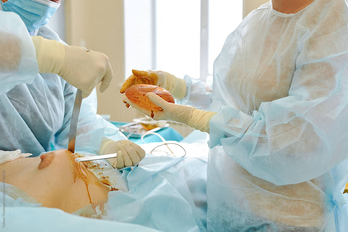 Expert Breast Surgery Procedures