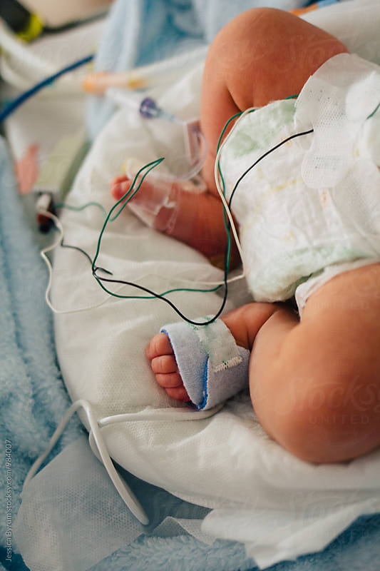 Baby in NICU hooked up to monitors