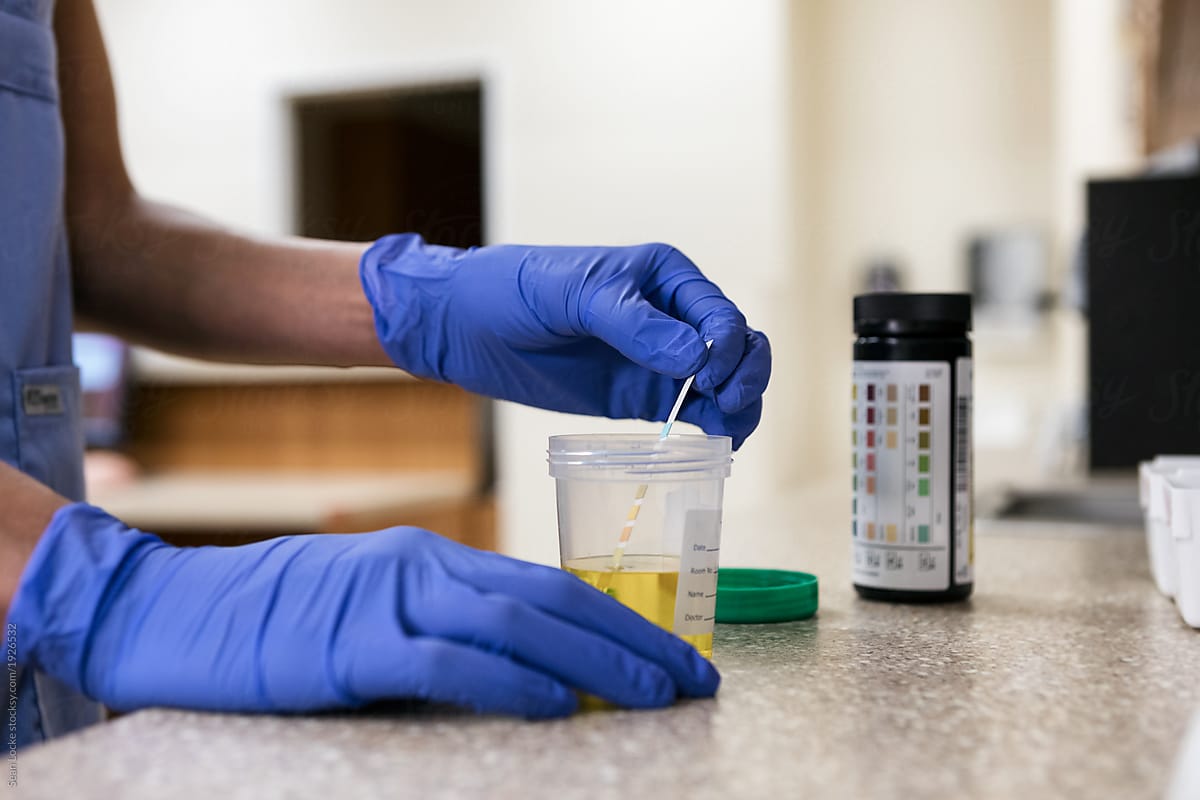 Clinic: Medical Technician Running Test On Urine Sample