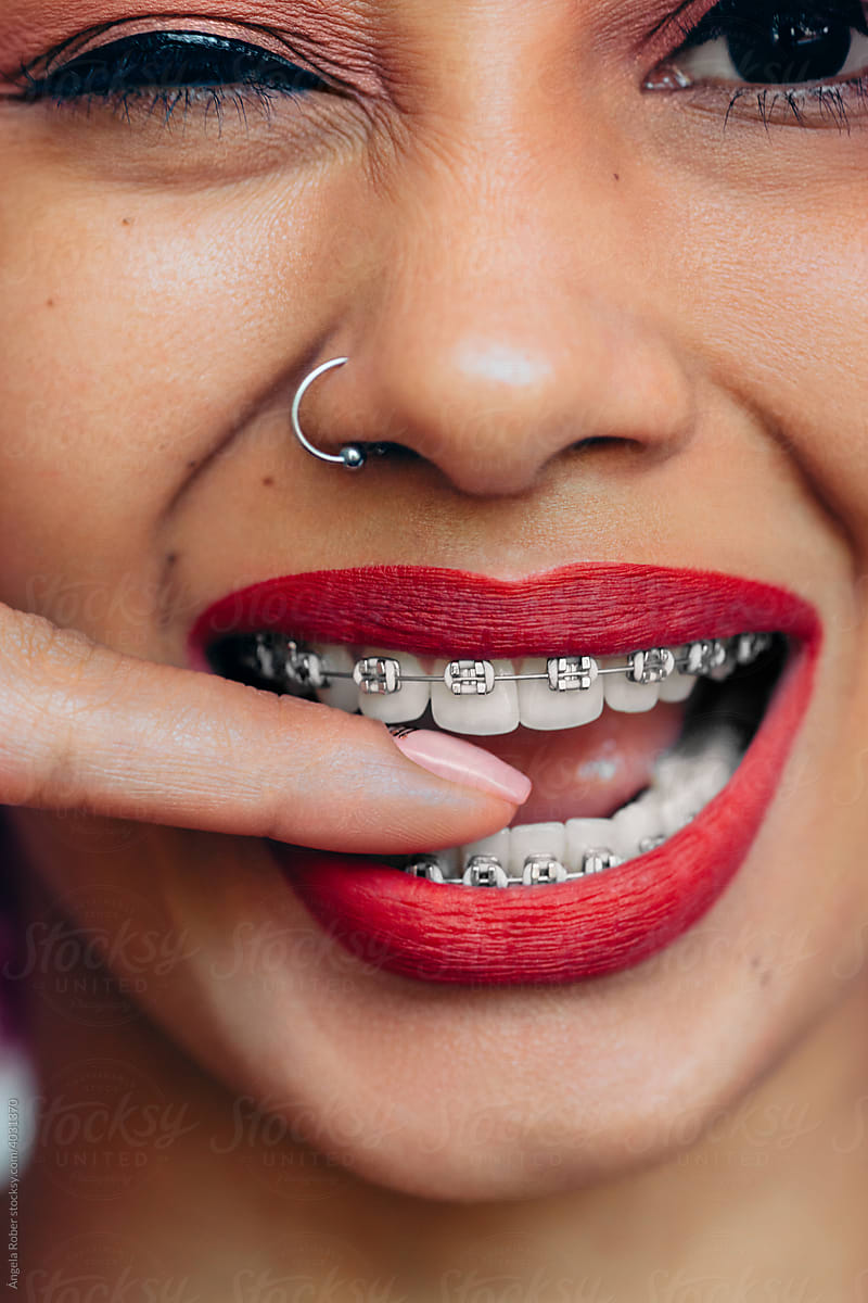 Portrait of a smiling woman with orthodontics biting her finger