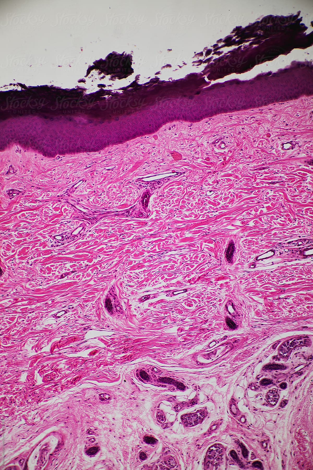 Thick layer cells of human skin