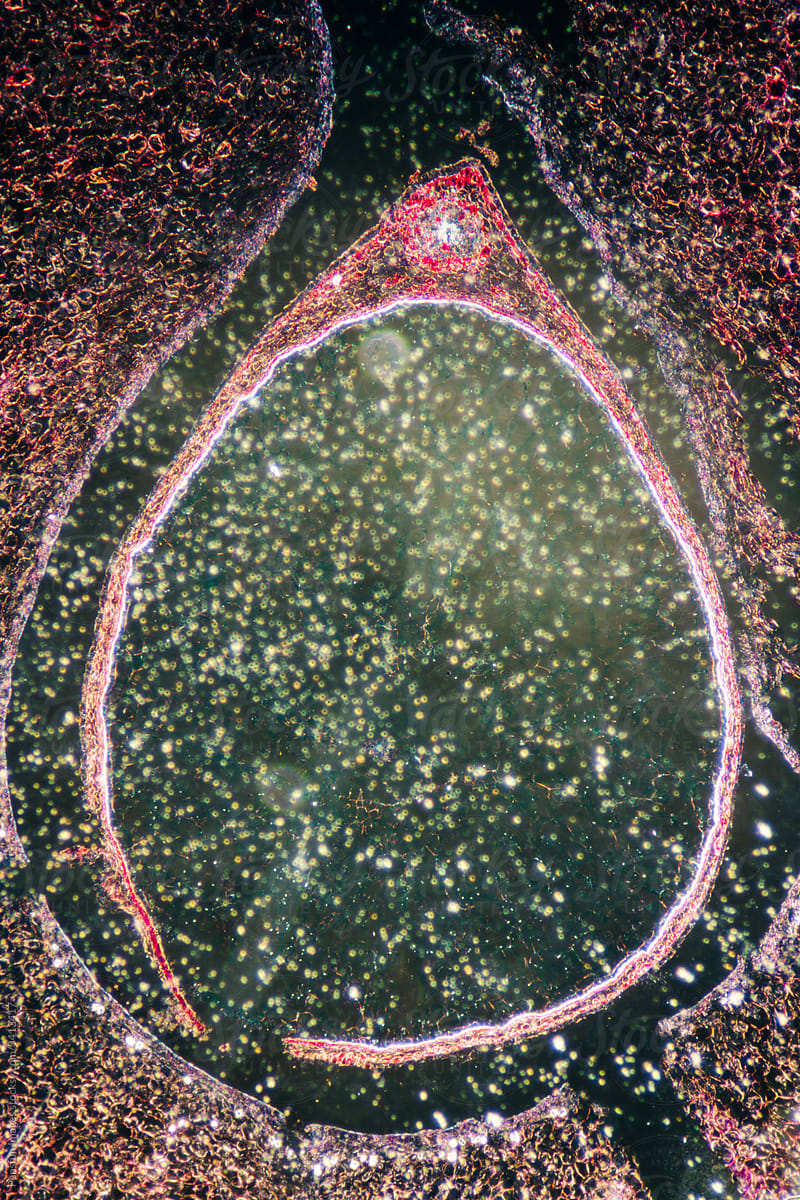 hawthorn fruit micrograph