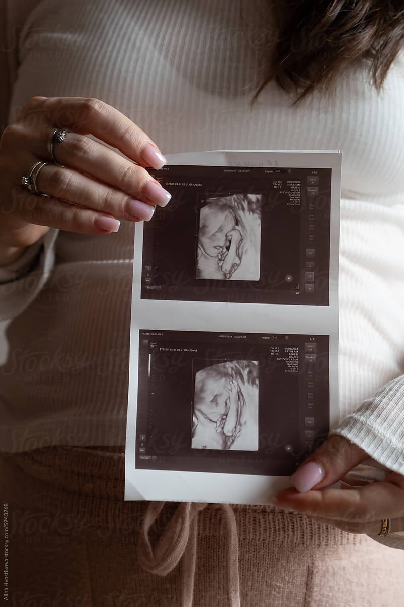 Crop pregnant woman showing ultrasound image