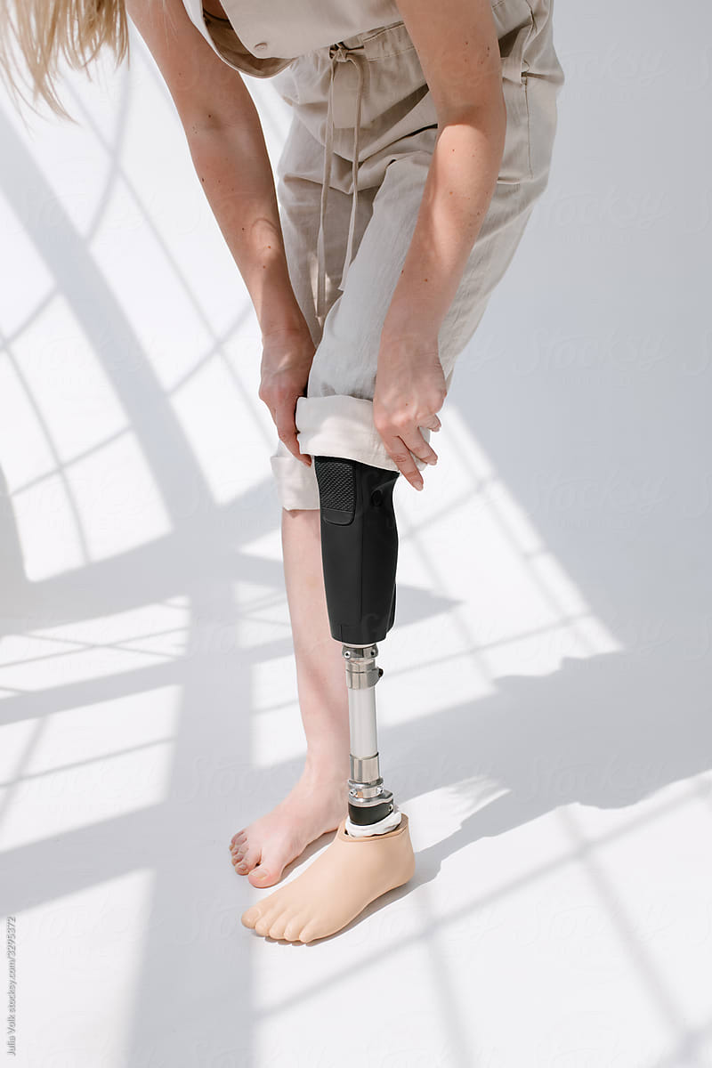 Woman With Leg Prosthesis