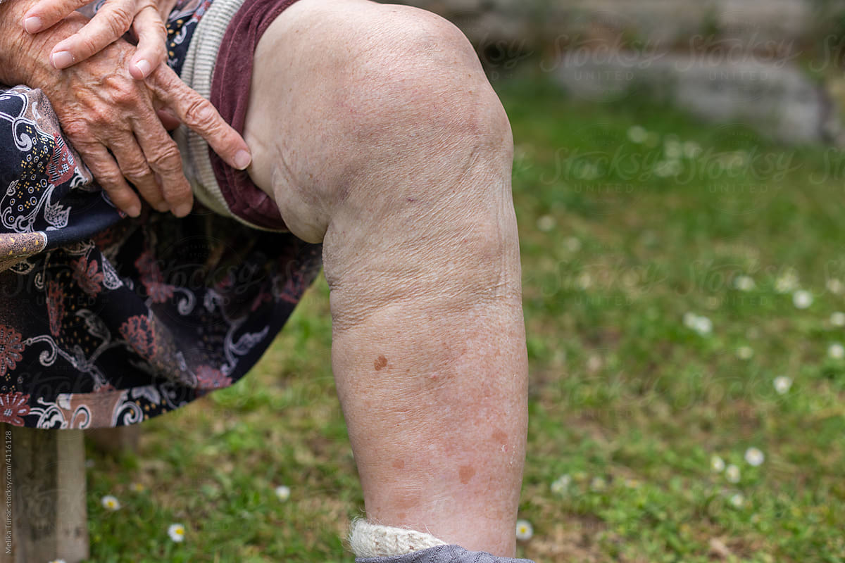 mature old woman touching knee joint