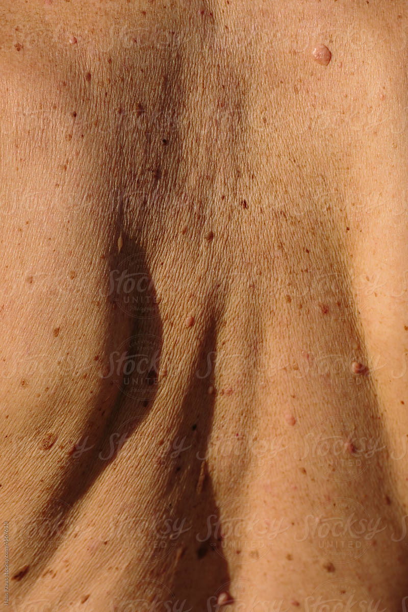 Skin textures