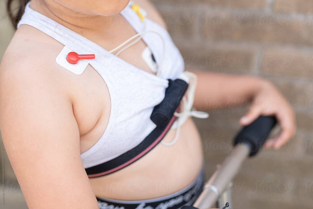 Chest of a 7 year old girl with a mobile Holter Cardio monitor