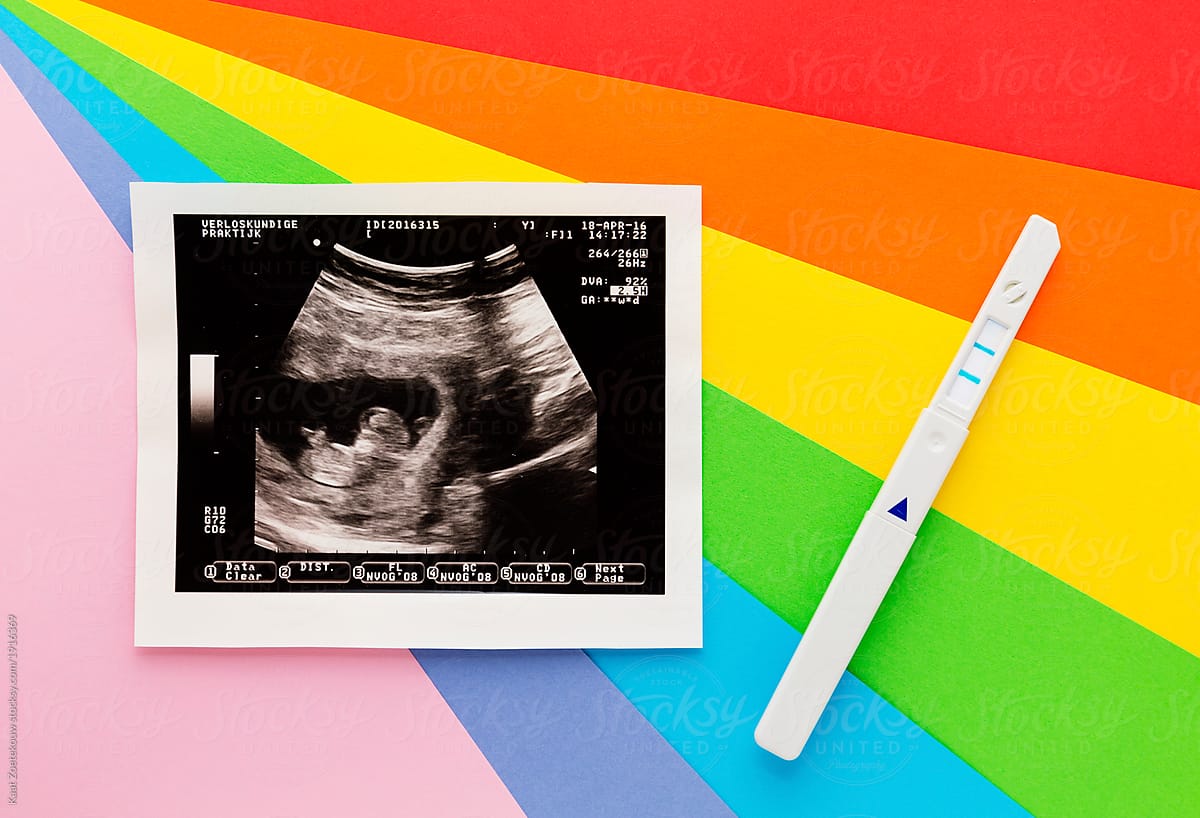 A rainbow baby is a baby that is born after a previous miscarriage or stillbirth