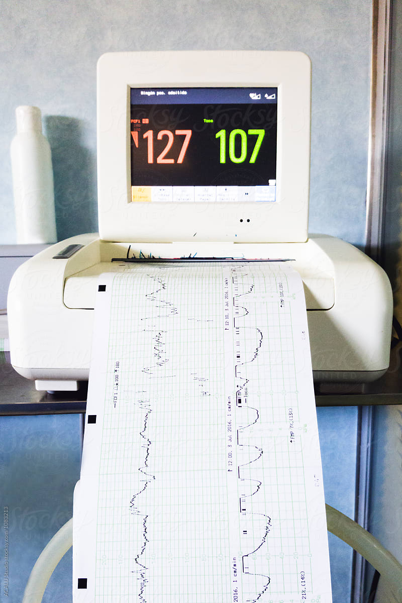 Electrocardiogram in a delivery room
