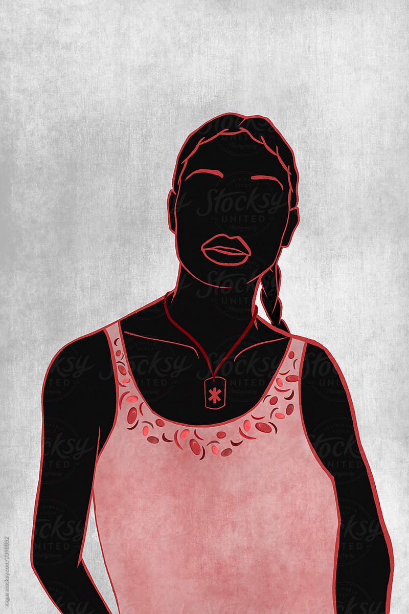 Anonymous woman with sickle cell