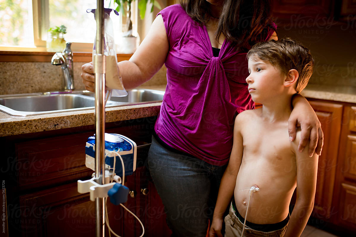 Boy with gastric feeding tube stands with mother in home kitchen