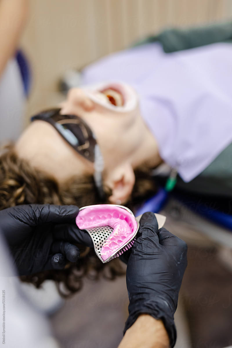 Teeth impression patient equipment model treatment procedure
