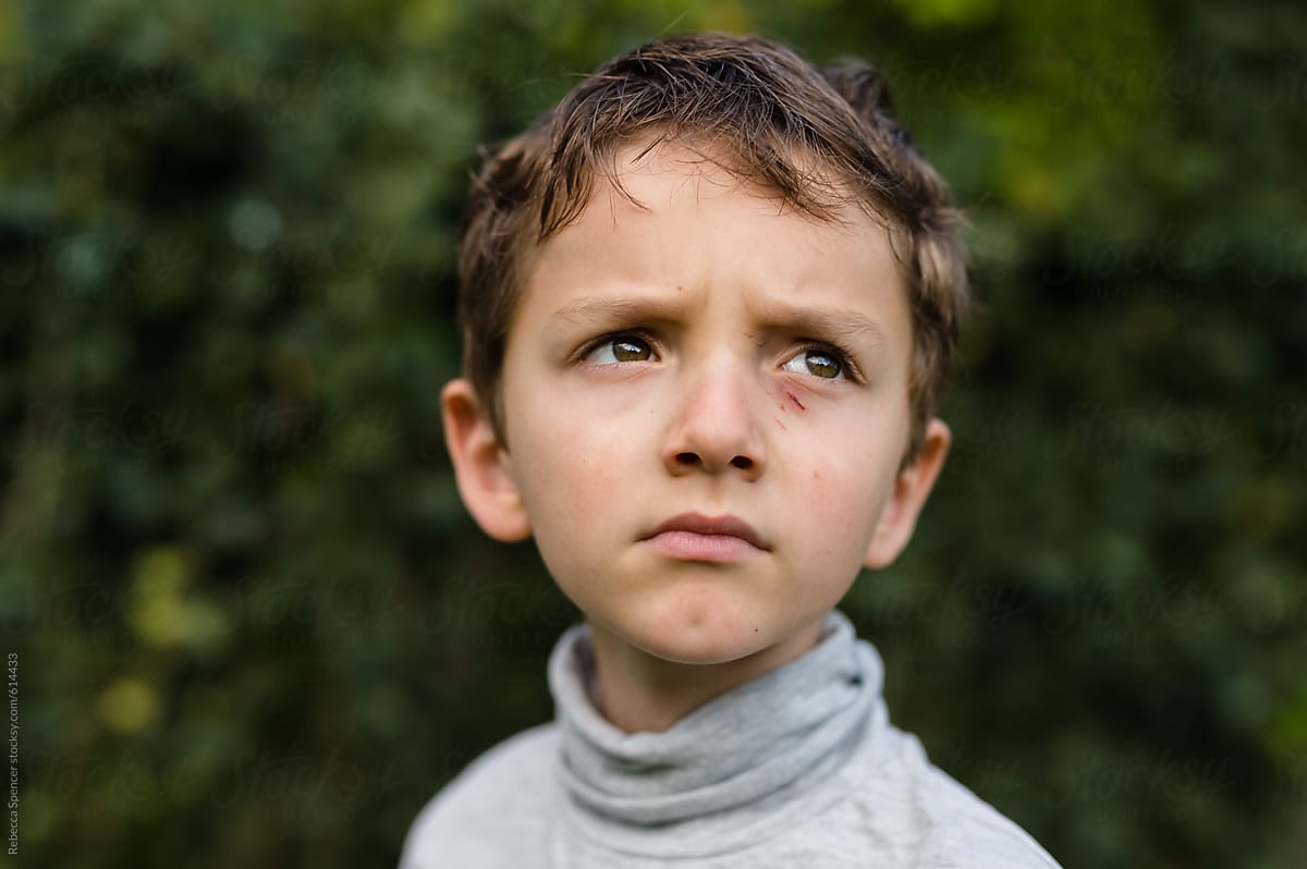 Boy with scratched face and eye