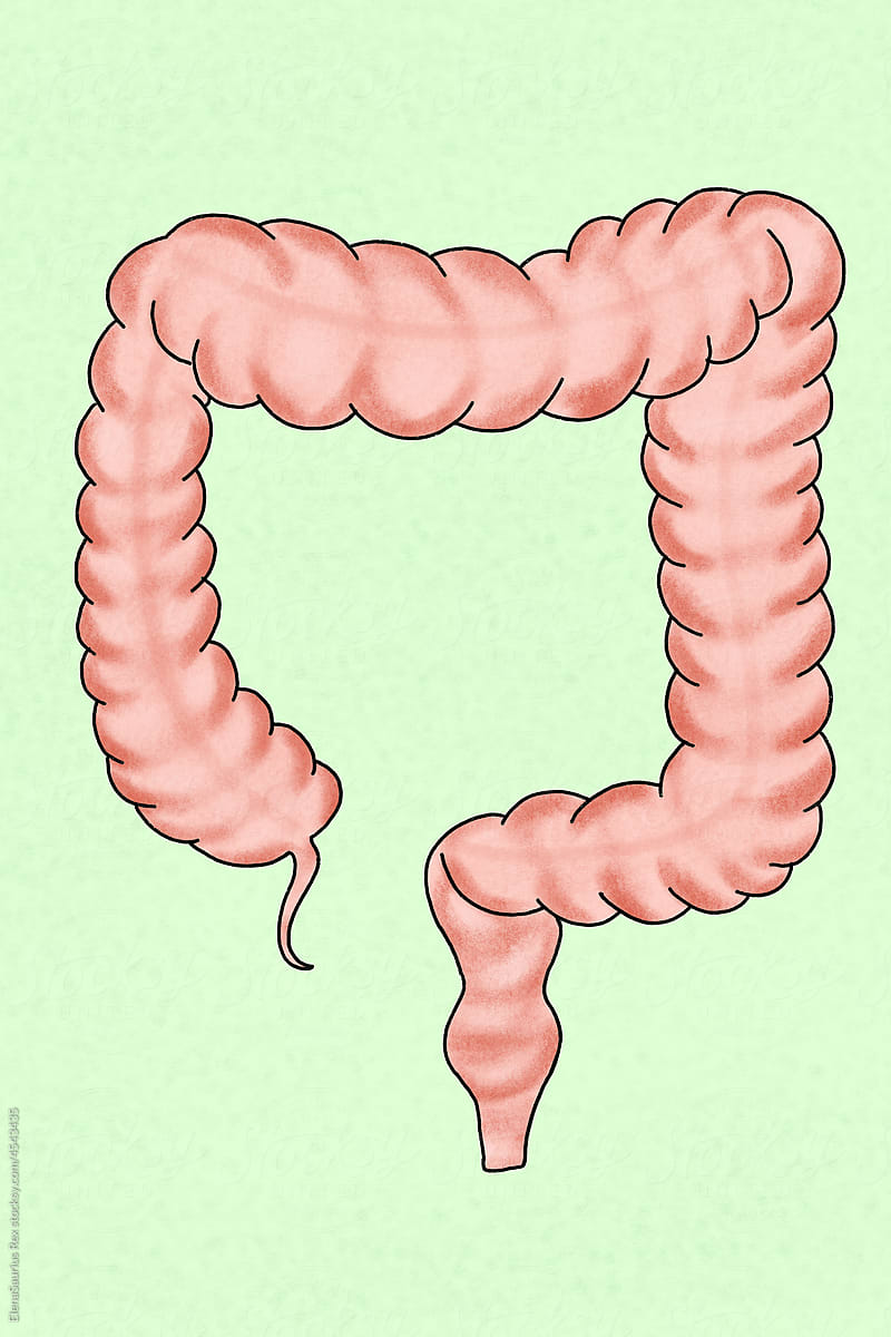 Picture of healthy large intestine