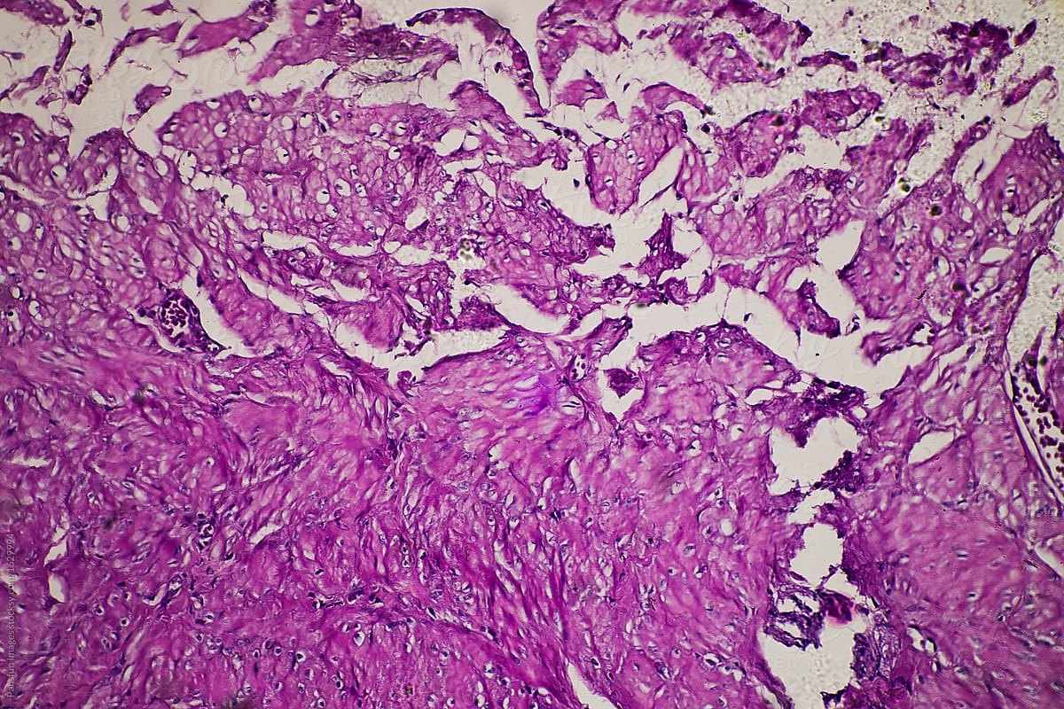 human stomach gastric mucosa intestinal metaplasia