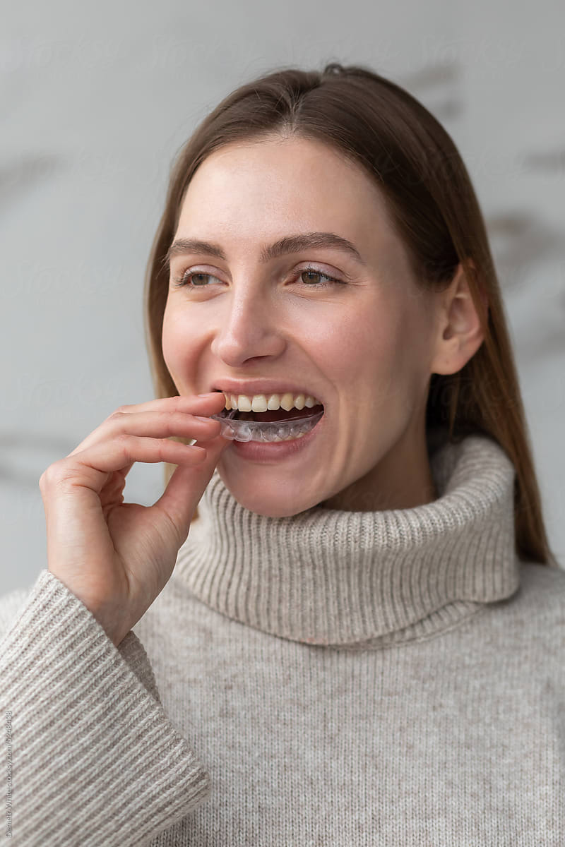 White woman trying to put on a transparent dental aligner