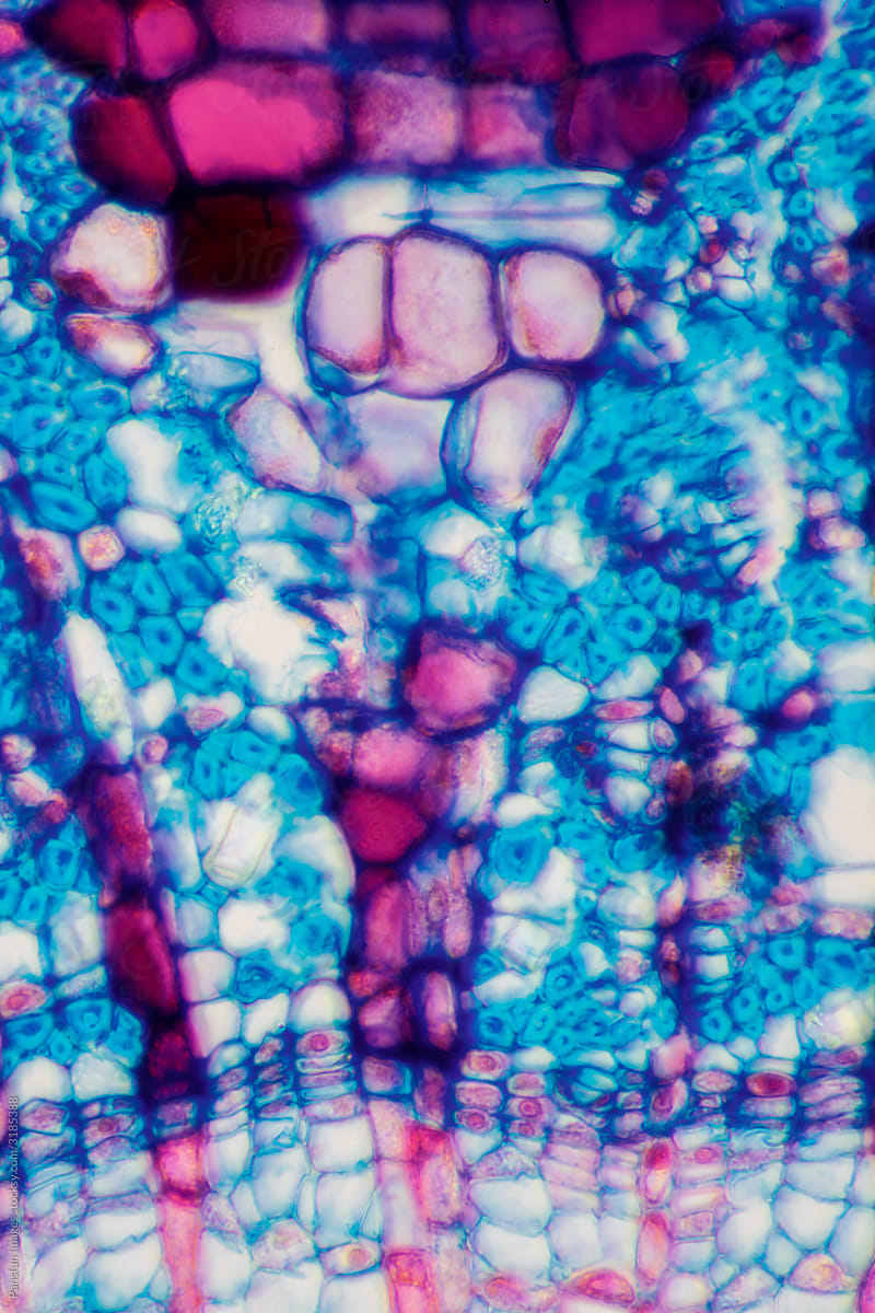 micrograph plant cells of woody dicot stem