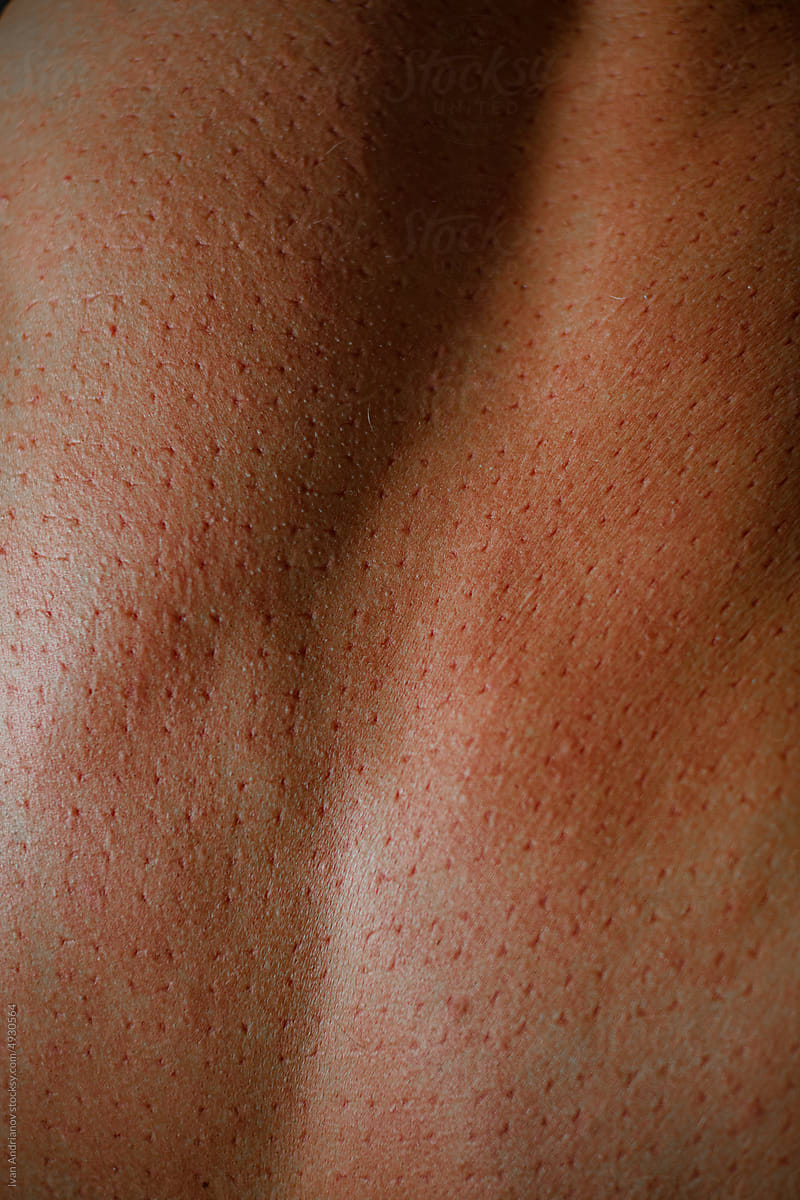 Back Skin With Marks From Needle Massage Mat