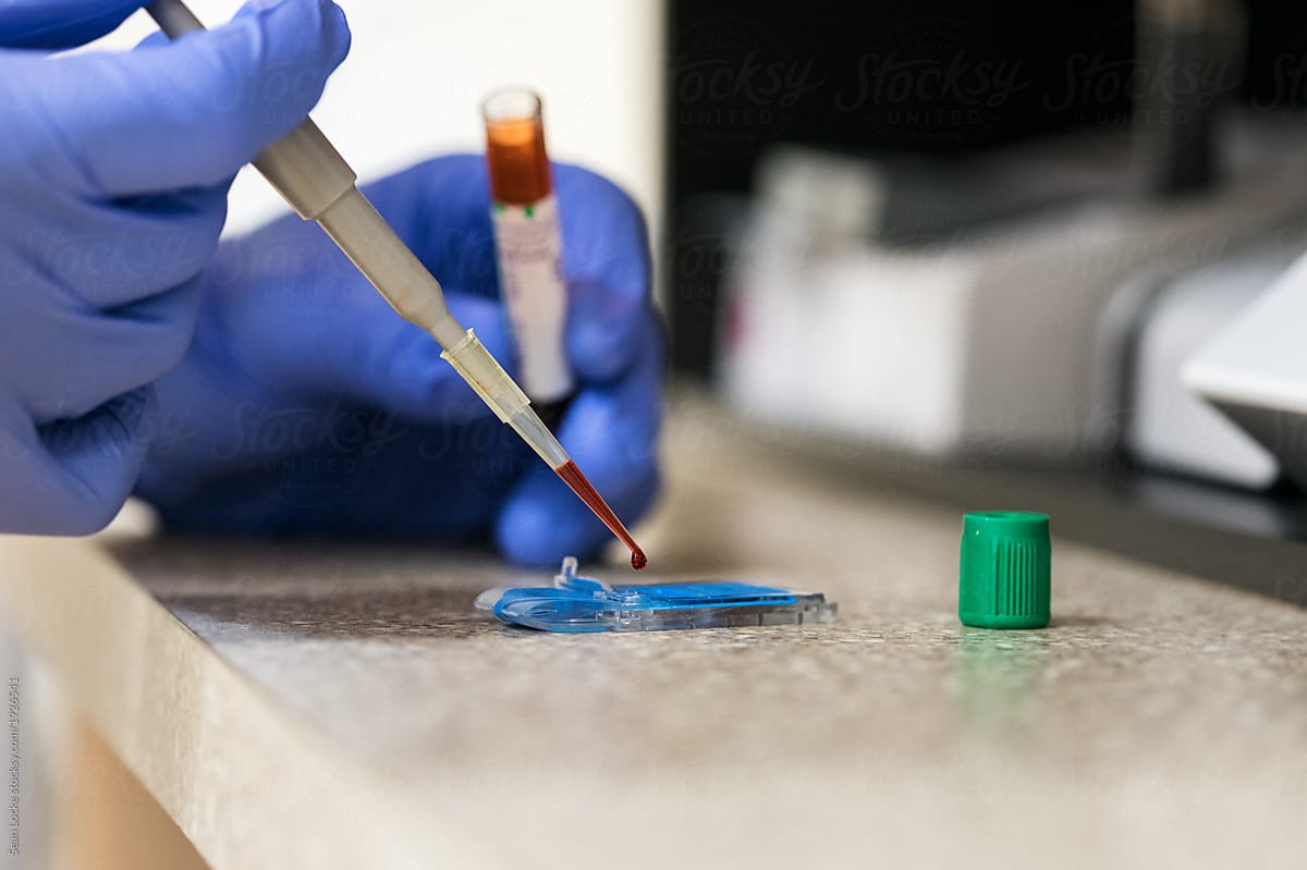 Clinic: Male Tech Running Blood Tests On Patient Sample