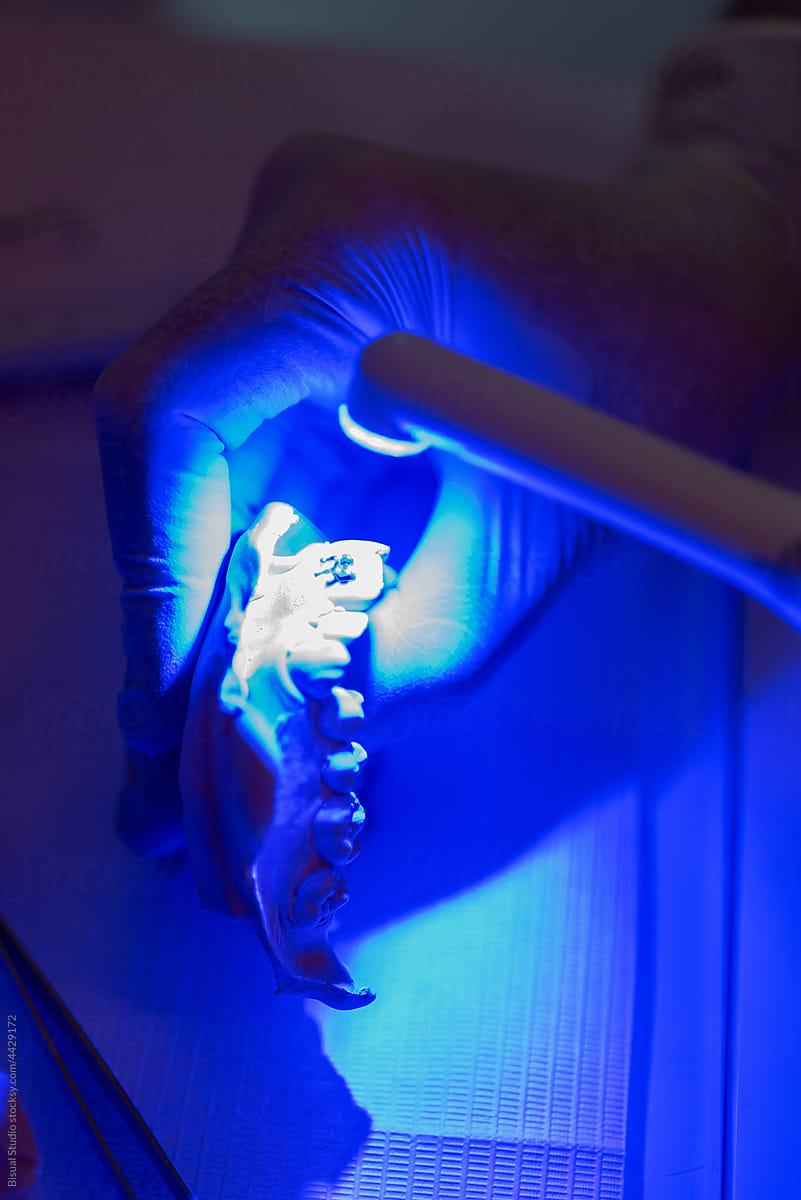 Crop orthodontist drying dental cast with blue light