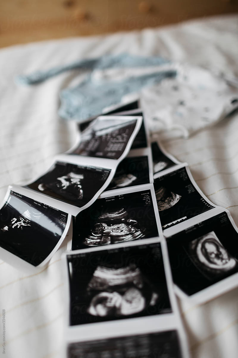 Ultrasound photos of a baby