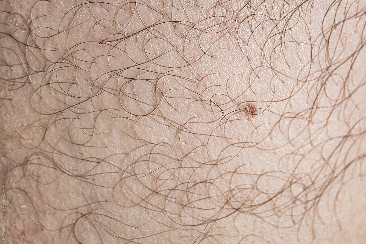 Body Hairy Skin With a Mole Texture Close-up