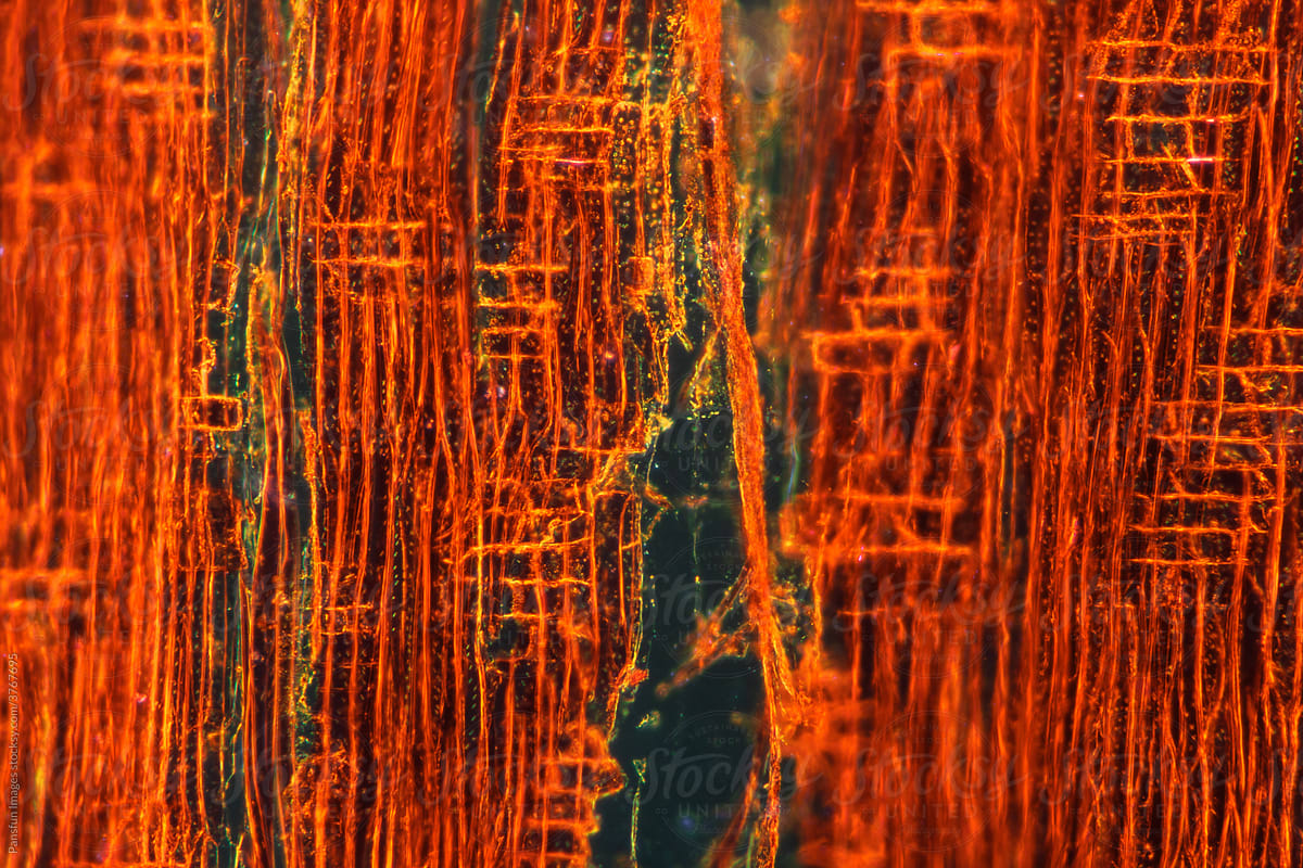 Agarwood plant cells micrograph