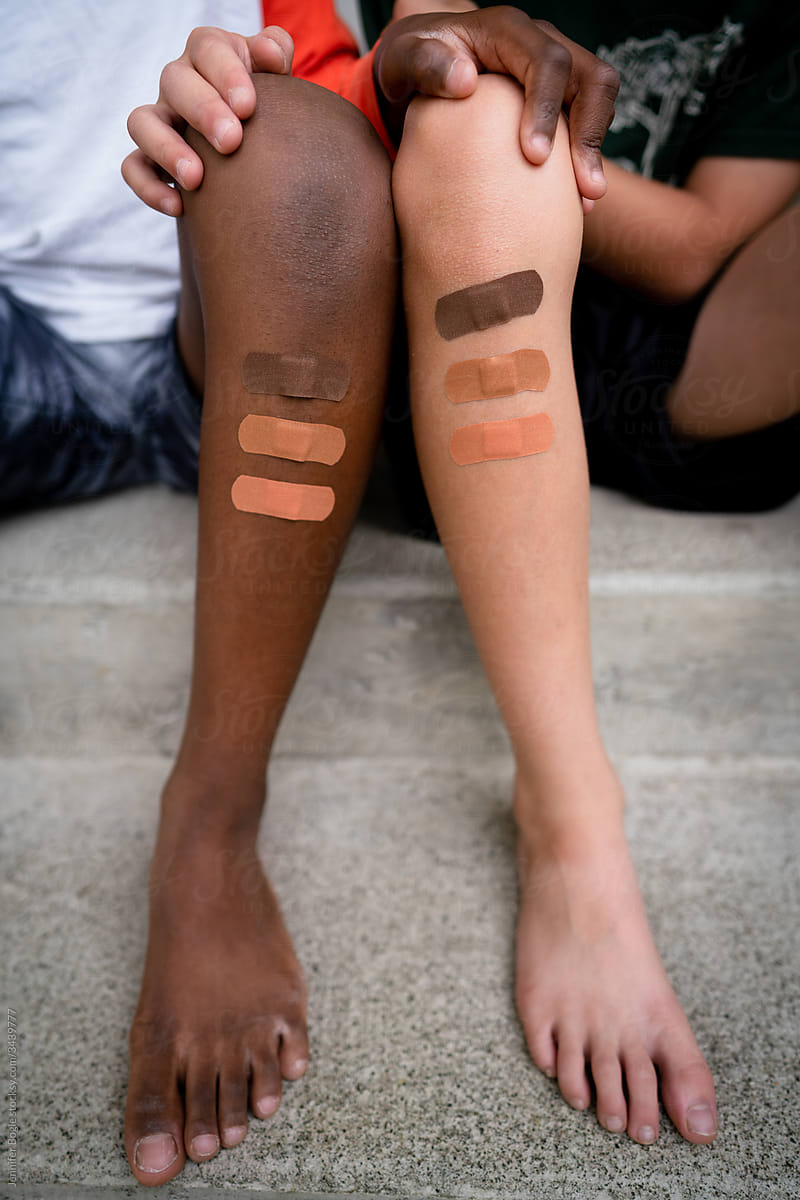 Multiracial brothers with multicolored bandages on legs