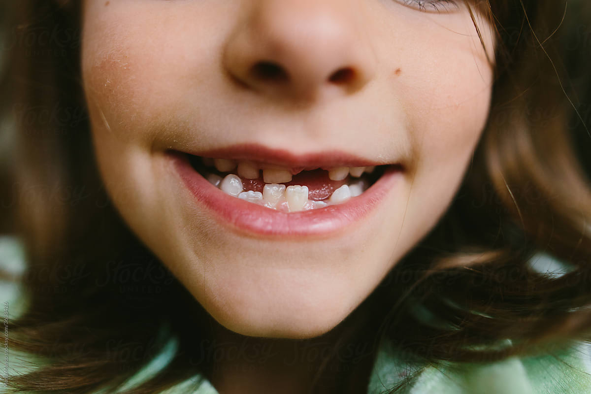 closeup of little kid with missing tooth