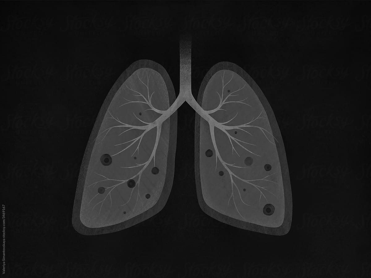 lung anatomy illustration