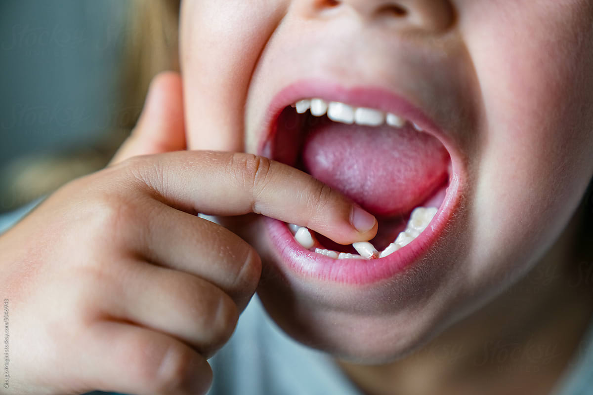 Child Touching Loose Baby Tooth