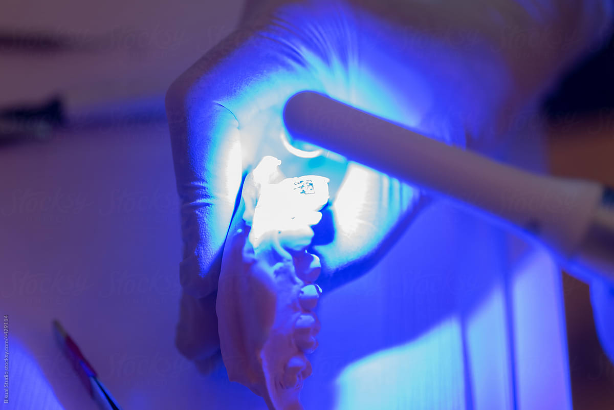 Crop orthodontist drying dental cast with blue light