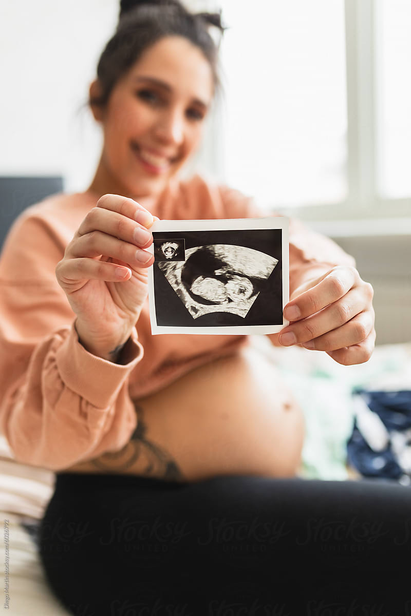Baby ultrasound-sonogram picture