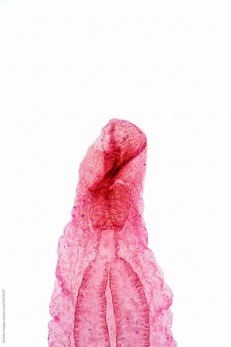 oral sucker  of Clonorchis sinensis adults micrograph