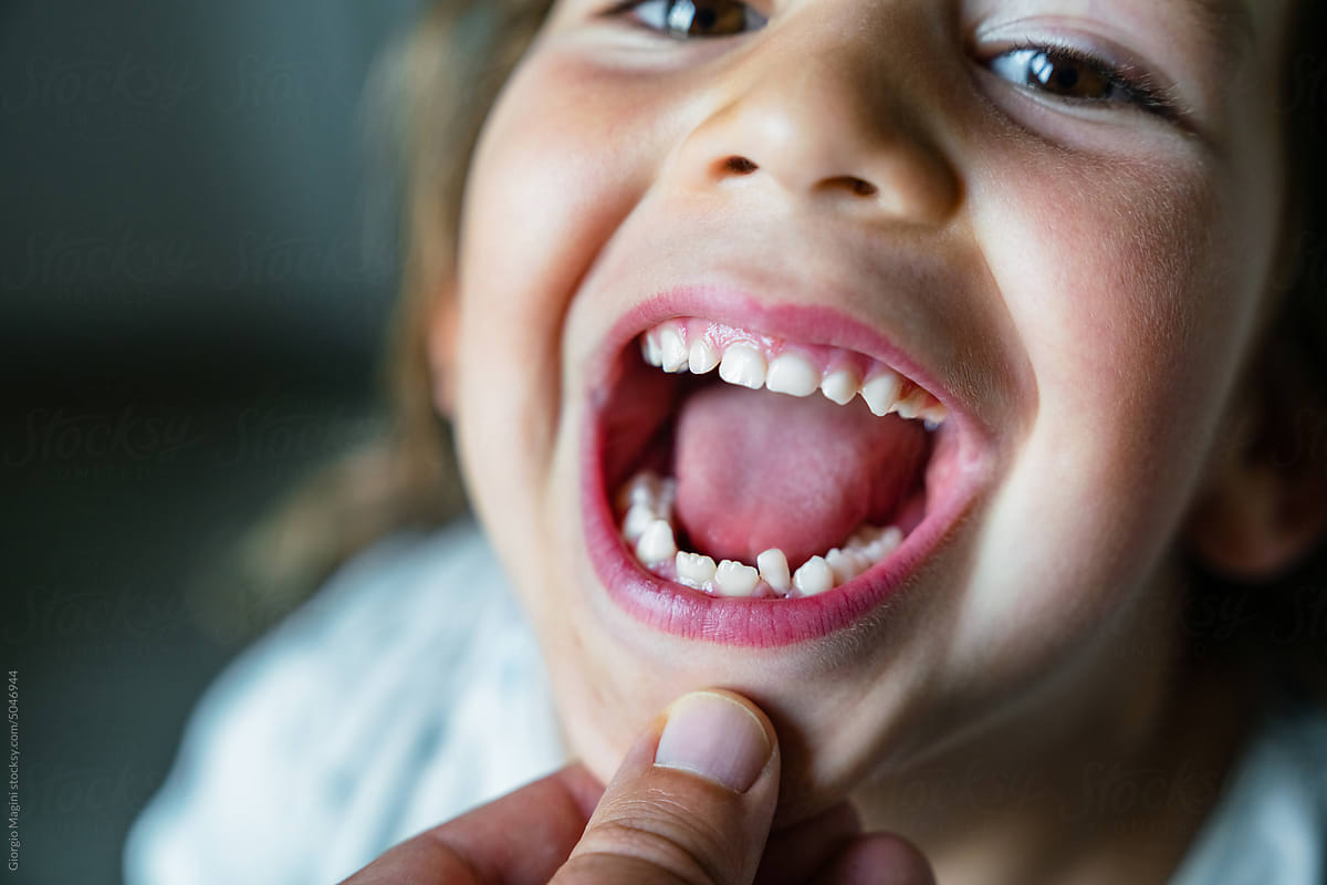 Little Girl Showing Loose Baby Tooth