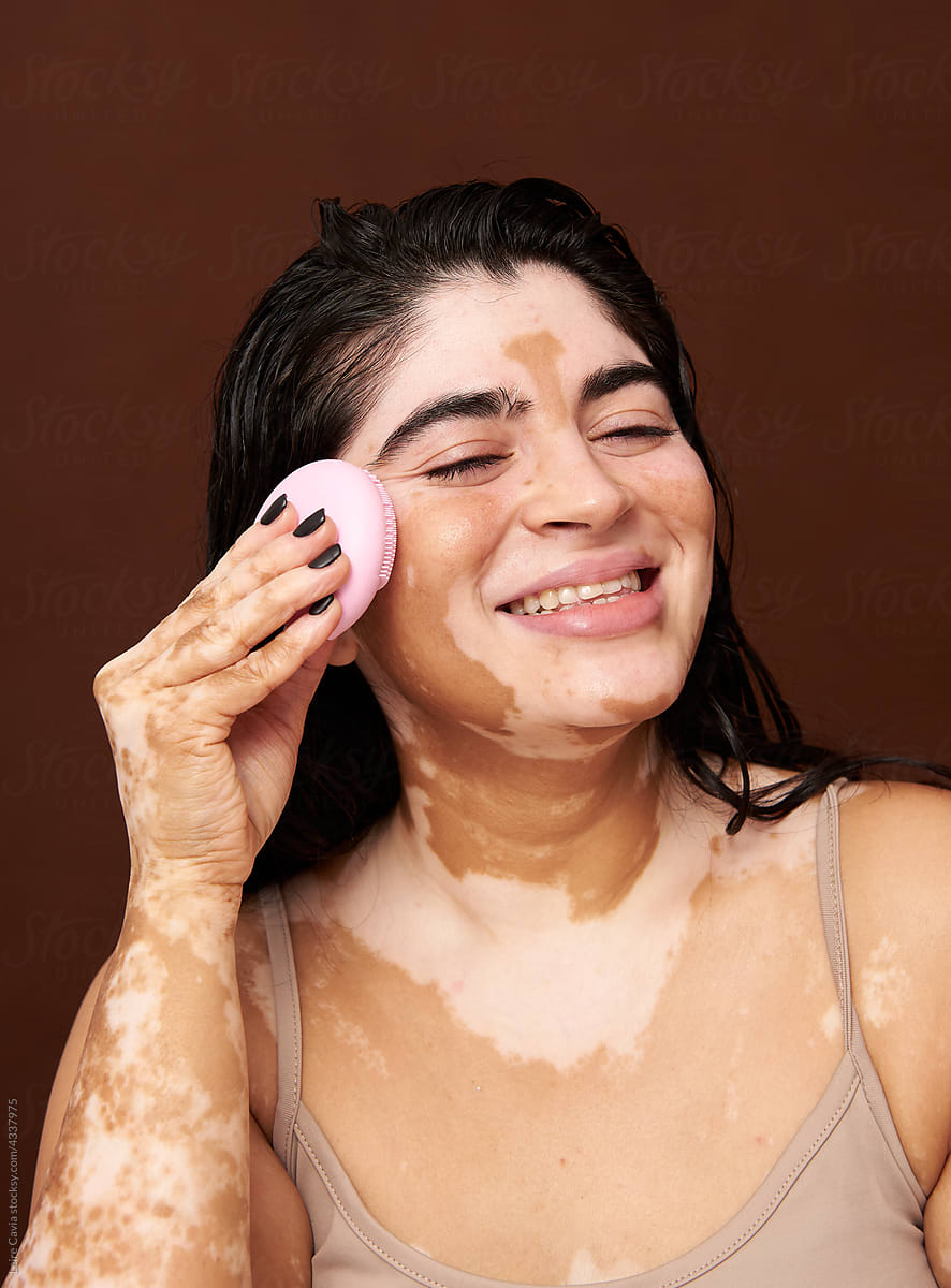 Vitiligo skin girl using a face cleanser device