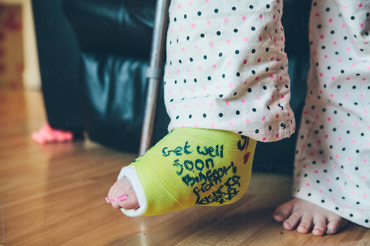 Teenage Girl With A Cast On Her Broken Foot By Kkgas