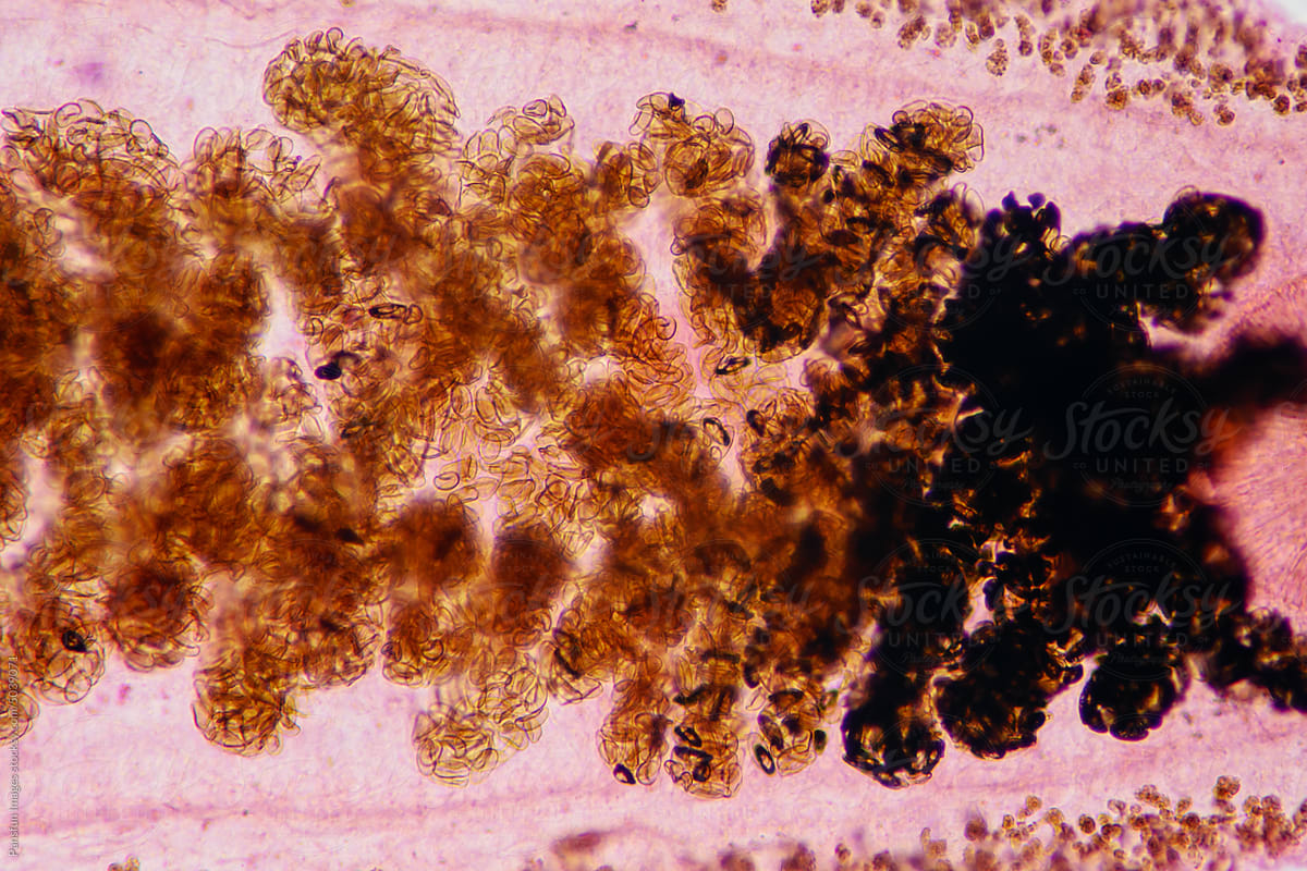 Clonorchis sinensis adults micrograph