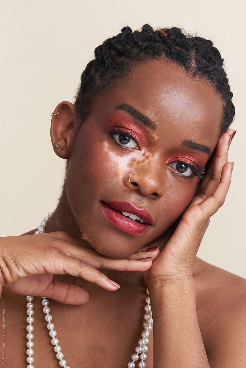 Beauty Portrait of Young Black Woman with Vitiligo Wearing Pearls