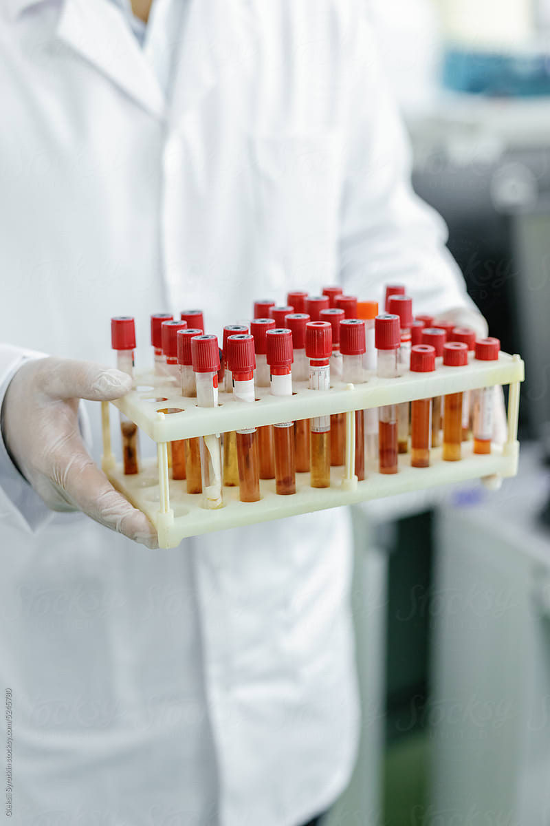 unrecognizable chemist sample test biotechnology clinic