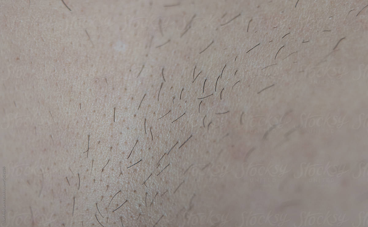 White Skin Texture With Growing Shaved Body Hair