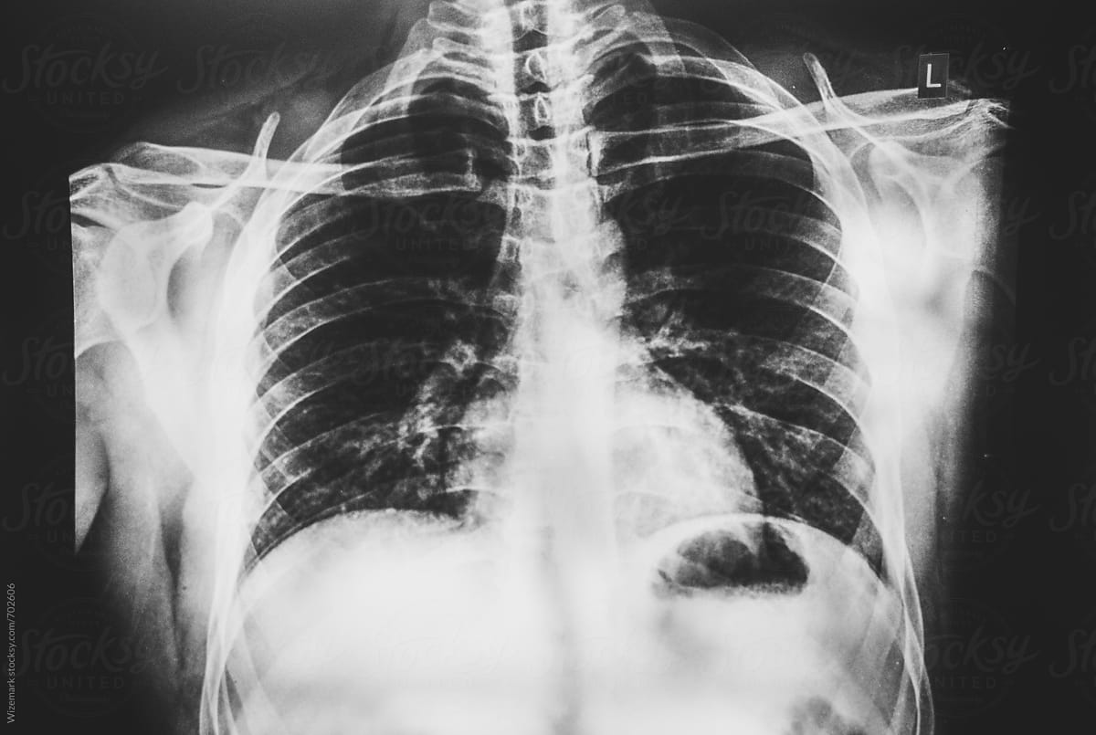 Chest, rib cage scan, x ray background