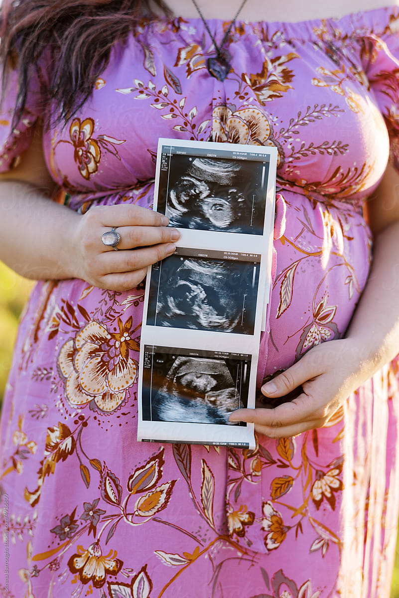close up of woman in pink maternity dress holding ultrasound picture